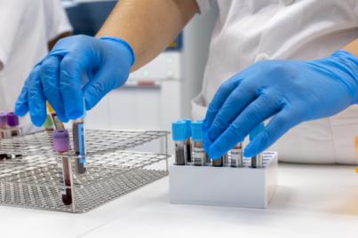 Sanidad notifica en Tenerife un brote de sarampión con cuatro casos confirmados