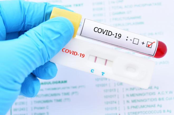 Sanidad registra 230 nuevos casos de covid-19 en personas de más de 60 años