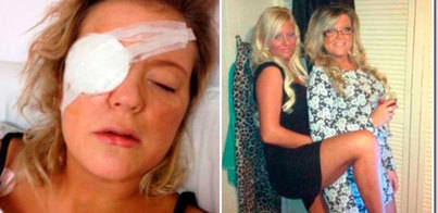 Condenada por clavarle un tacón en el ojo a su amiga